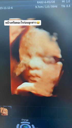 29 w ซาว 3 มิติ