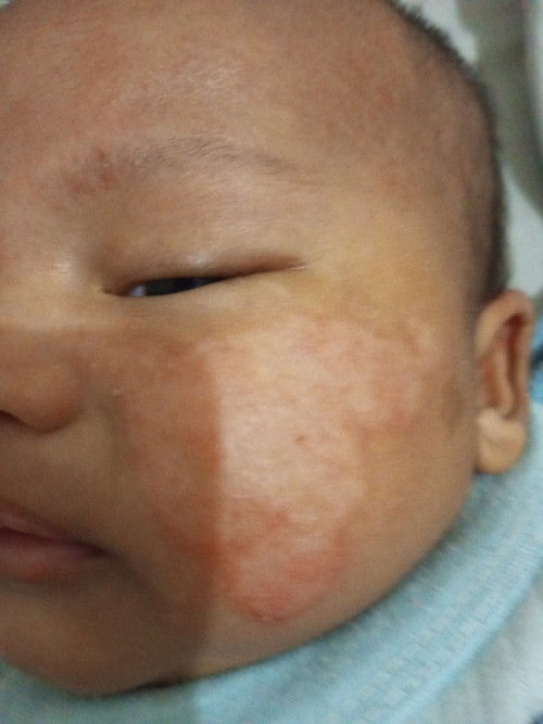 Obat atau krim wajah bayi