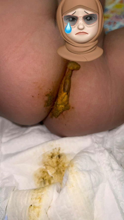 BAYI 7BULAN SEMBELIT