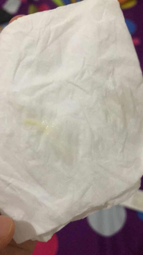 Tanda persalinan atau buka