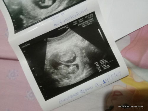 Twin Baby ❤️👶🏻👧🏻