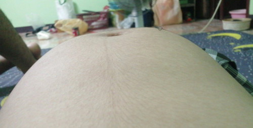 33+เจ้บท้องหน่วงๆ ต้องสะดือเป็นล่อง