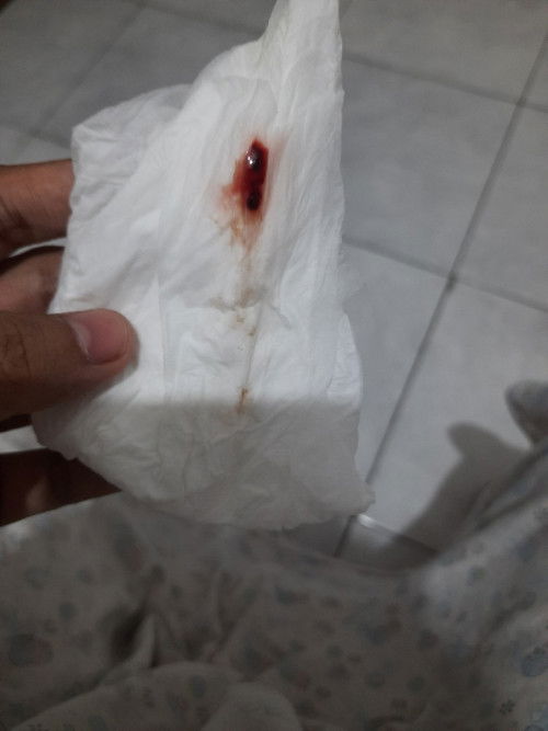 Hamil 37 week 4 hari keluar darah disertai nyeri² kontraksi