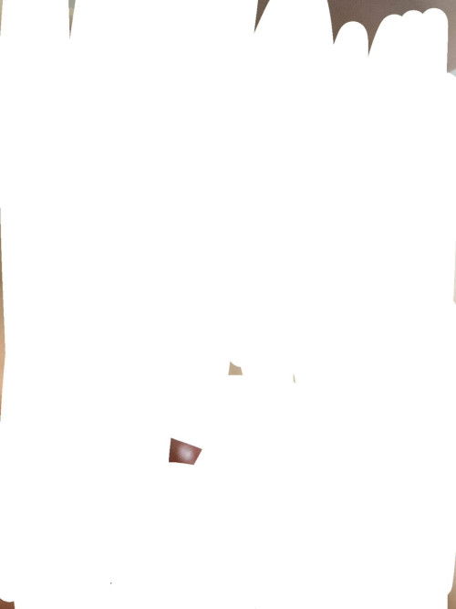 tháo,vòng đầu tháng trước nay e trể 12ngày,qua thử que 1v h.nay e thấy ngực co mụn em nặn ra mụn sữa