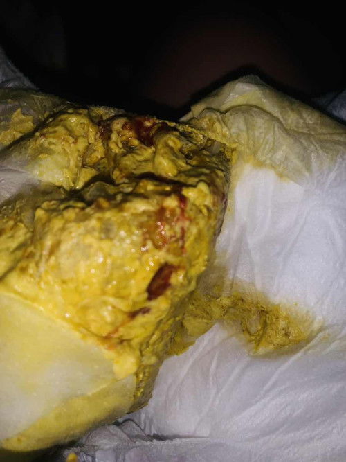 Bayiku umur 3bln pup darah lendir