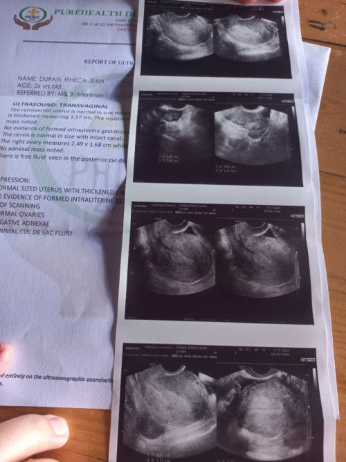 6 weeks and 3 days ultrasound .