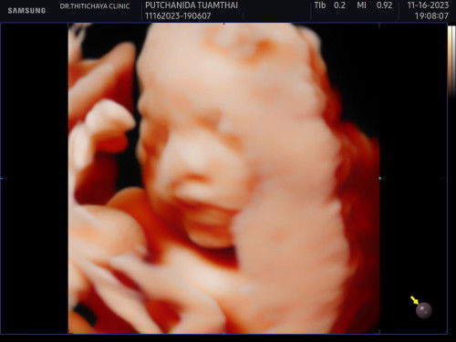 หนุ่มน้อย 27 week ❤️❤️