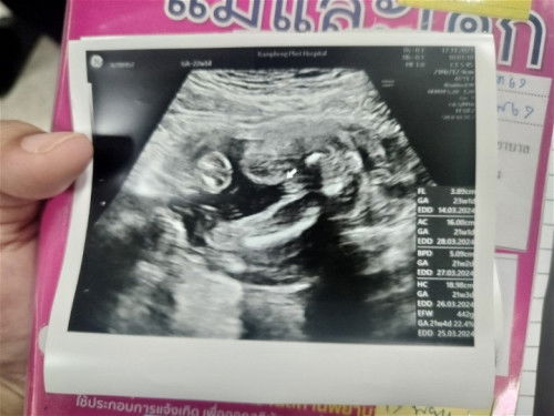 สอบถามค่ะแบบนี้หญิงหรือชายค่ะ 
คุณหมอบอก อาจเป็นผู้หญิง แต่ก็ยังมองไม่ชัด