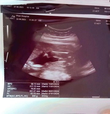 เพศลูกในครรภ์