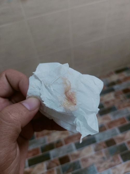 สอบถามแม่ๆหน่อยจ่ะ