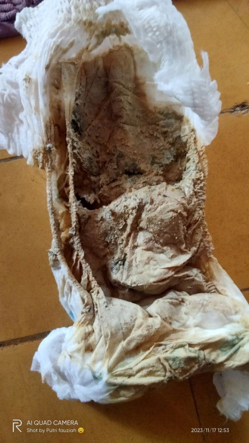 Pup bayi knapa ya kaya gini ini diare atau apa ya soalnya cair bnget
