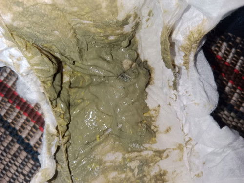 Warna pup bayi 4 bulan sufor warna hijau