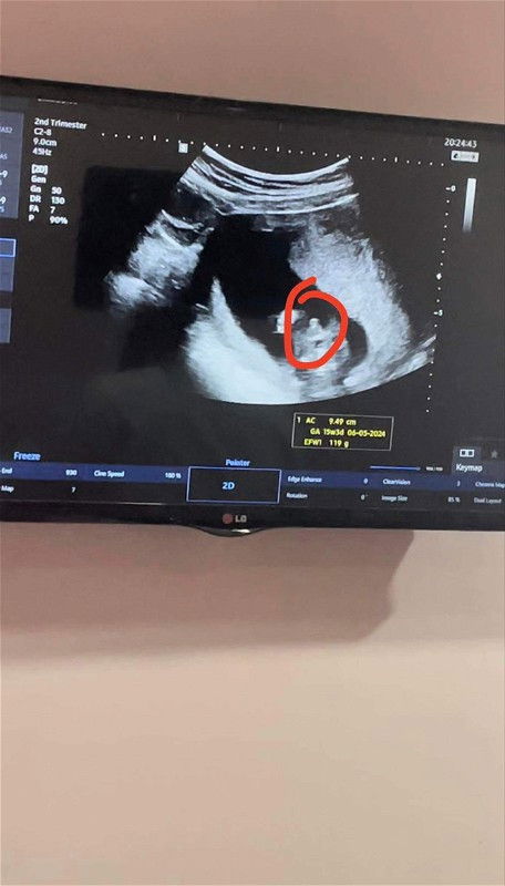 เพศไหนคะช่วยดูหน่อยแต่คุณหมอยังไม่ยืนยันว่าเพศไหน