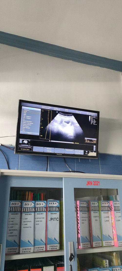 Bun mau tanya ini aku kemarin udah 7 Minggu waktu dicek ke puskesmas tapi kata dokternya belum ada