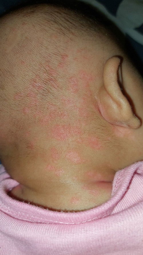 Bunda kayak gini ruam apa bukan ya