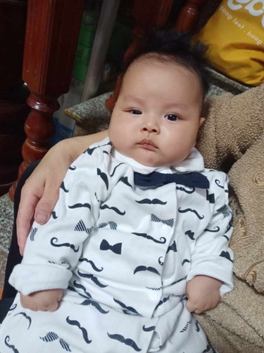 Đau mắt đỏ thương con quá các mẹ biết thuốc gì đỡ ko ạ em thuốc nhỏ mắt mà ko thấy đỡ tí nào thêm