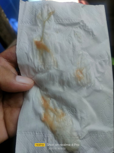 Pagsinga ko po para syang may kasamang dugo . Sa kanang butas ng ilong ko . may sipon po ako 4days
