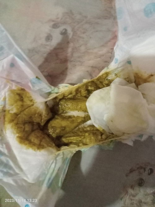 Ask ko lang mi .Ganto Po kulay nang dumi parang may plema tas kulay green  empatso ba to  ?