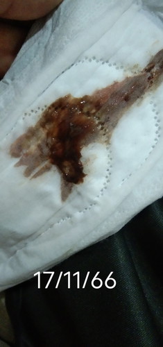 โดนกระตุ้นปากมดลูกแล้วมีเลือดออก