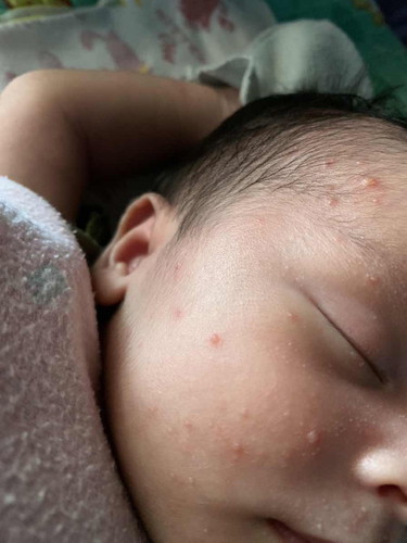 Obatnya apa ya bund?