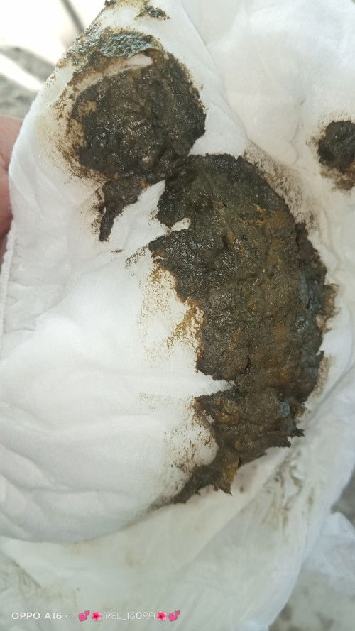 Maaf jorok Bun mau tanya dong pup bayi saya wrnanya hijau tua pekat seperti itu... Apakah normal