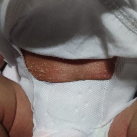 Normal lang po ba ito sa newborn baby? 2weeks and 5 days na po baby ko, ngayon lang po ito nagkaroon