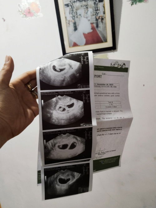 My TransV result🥰