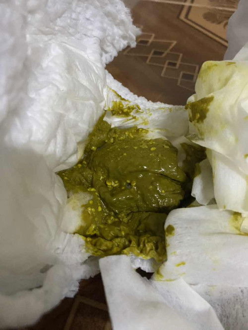 อึแบบนี้ปกติไหมค่ะ