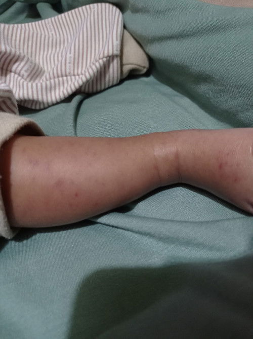 Ada yg pernah ngalamin ?