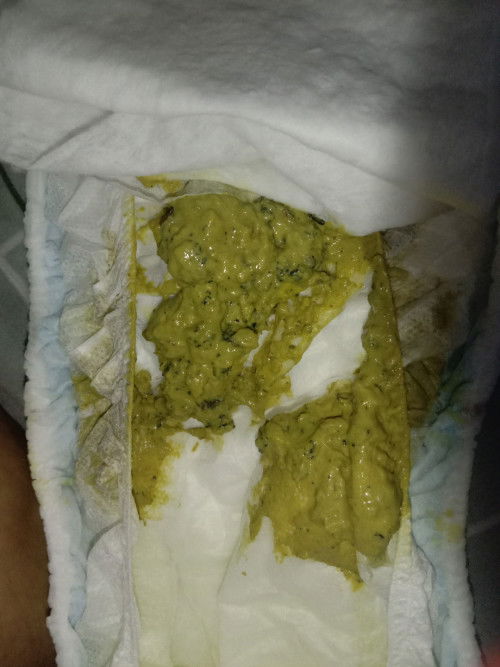 something black in poop