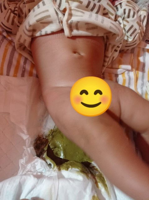 Pup bayi warna hijau, bau dan demam
