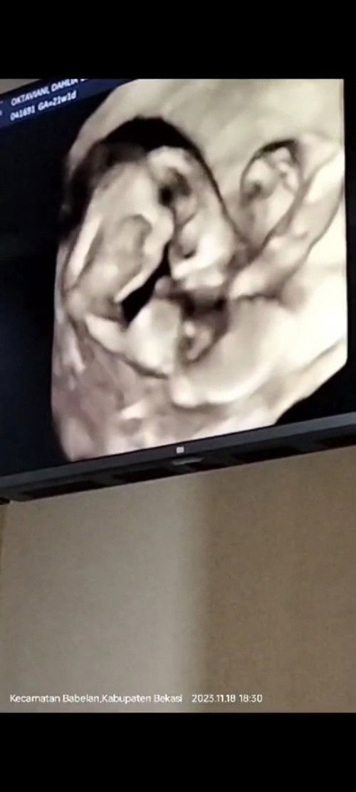 Alhamdulillah terima kasih ya Allah