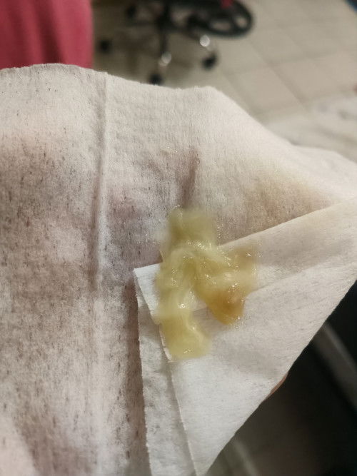 35 weeks and 4days Pregnant