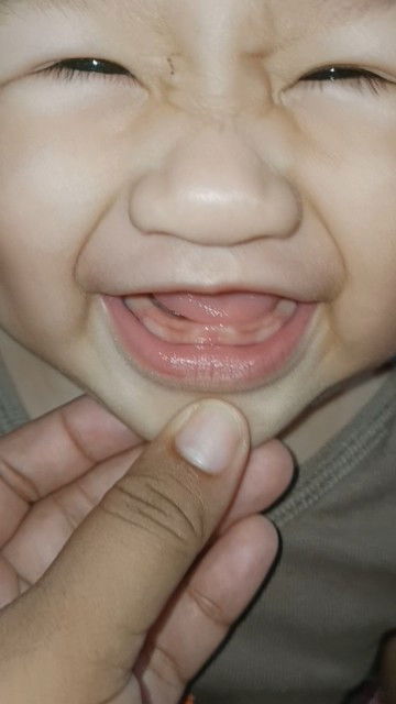 Mga mamshieee, ask ko lng po kung ngipin na ba yang pumuputi sa gilagid ng baby ko po?