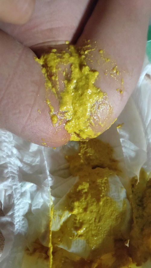 แบบนี้ลูกท้องเสียมั้ยคะ