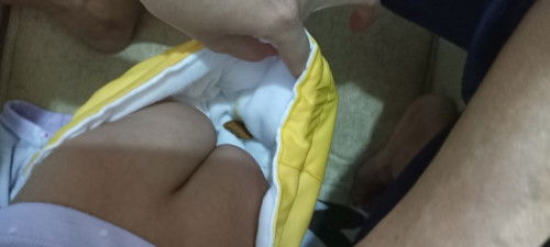 Apakah bayiku sembelit