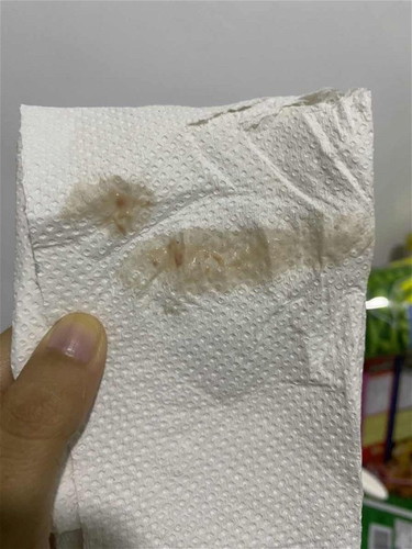 sebelum ni keputihan keluar. harini keluar macam air dan ade sedikit coklat2