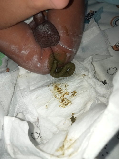 ขี้เหนียวปกติมั้ยคะ