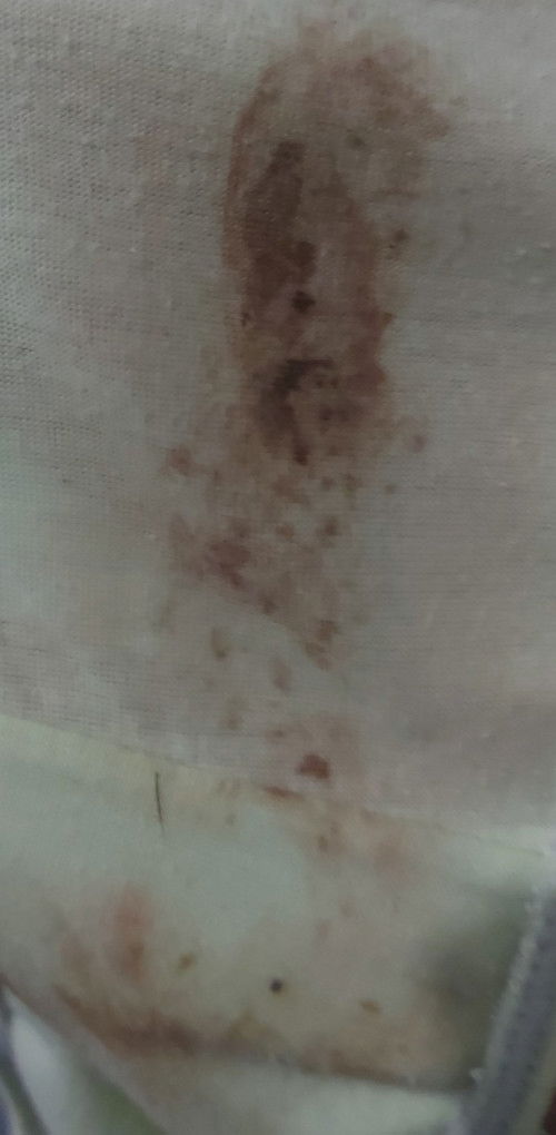 brown discharge at 37 weeks