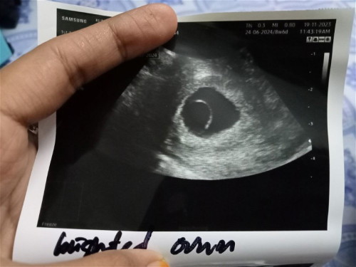 8week 6day