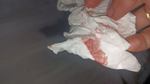 divonis hamil BO USG 8 week bsok mau USG lg,kluar flek & kram,smoga ad keajaiban. minta doanya bun🥺