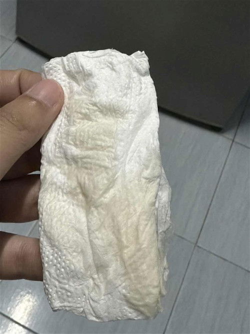 ปวดหน่วงเหมือนเป็นประจำเดือน มีน้ำใสใสออกเหลืองนิดๆไหลประปริบออกมานิดหน่อย