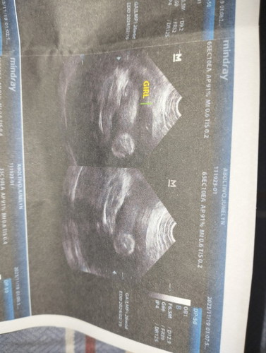 Gender Result : Girl or Boy?