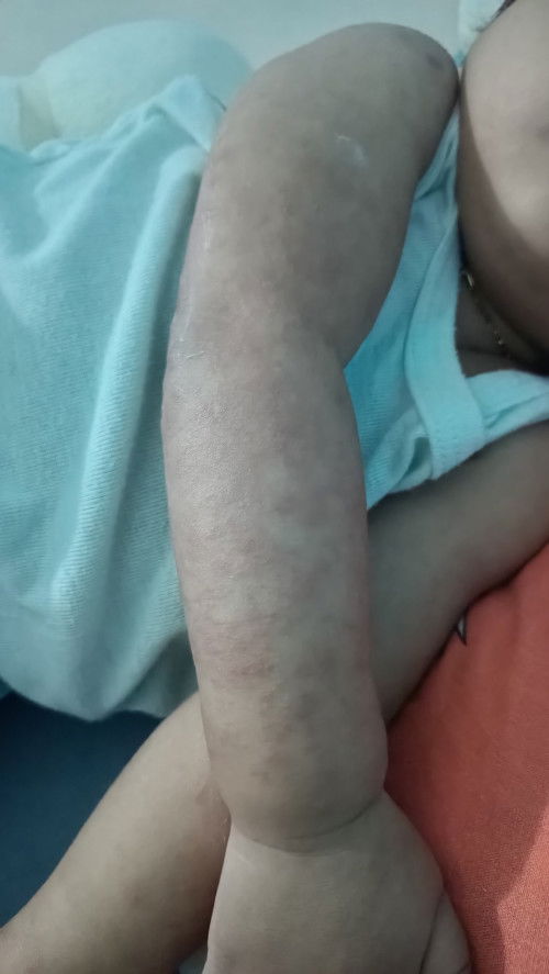 Bayi 9 bulan keluar merah2