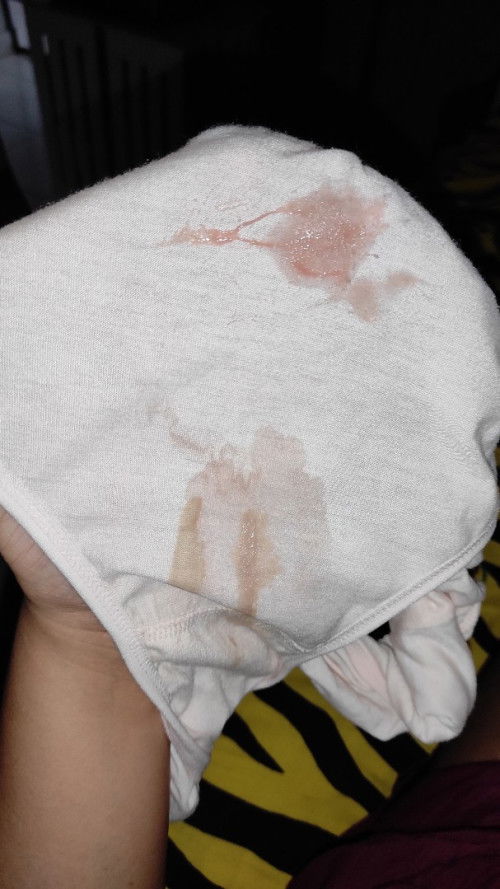 Keluar bercak warna pink dan lendir, tanda pembukaan bukan?