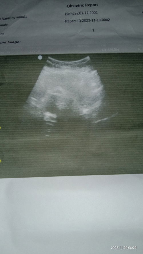 Bun usia kandungan aku 7w dan mengalami flek coklat di usg hasil nya gk terlalu jelas