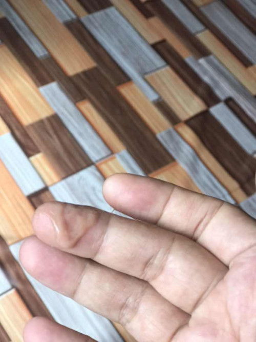 Lendir di dalam vagina