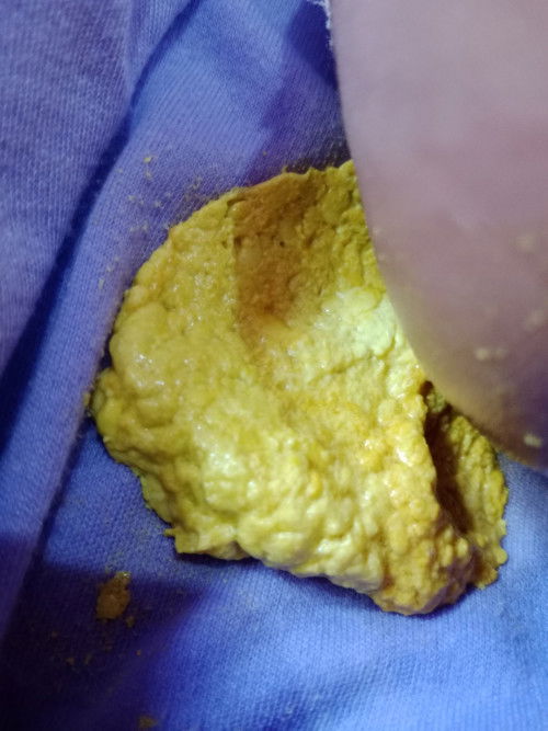 bund BAB bayi minum susu formula SGM kaya gini normal gk? Mff kl jorok 🙏