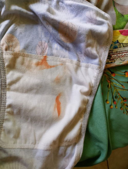 timbul bercak seperti itu dsebabkan karna apa