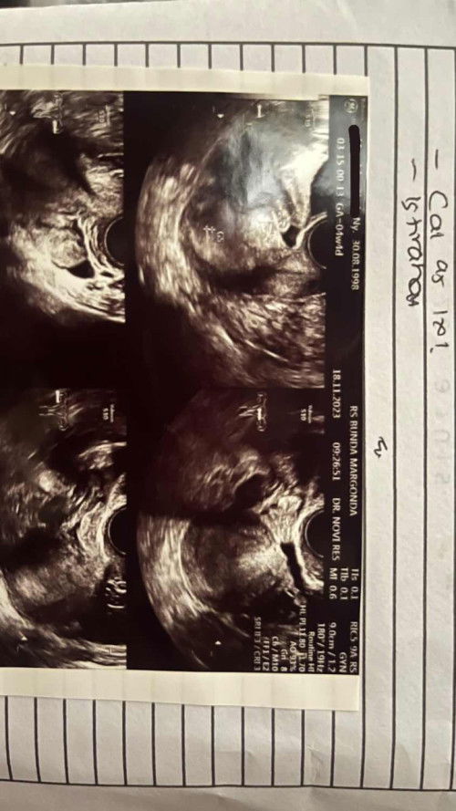 Tanya dong Buibu🫶🏼